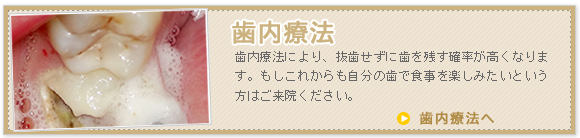 一度治療した歯が腫れる、治療後も違和感が取れないなどの経験はありませんか？基礎となる根管治療はとっても大切です。しっかりとした治療米国式歯内療法の紹介です。