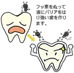 フッ素をぬって歯にバリアをはり強い歯を作ります。