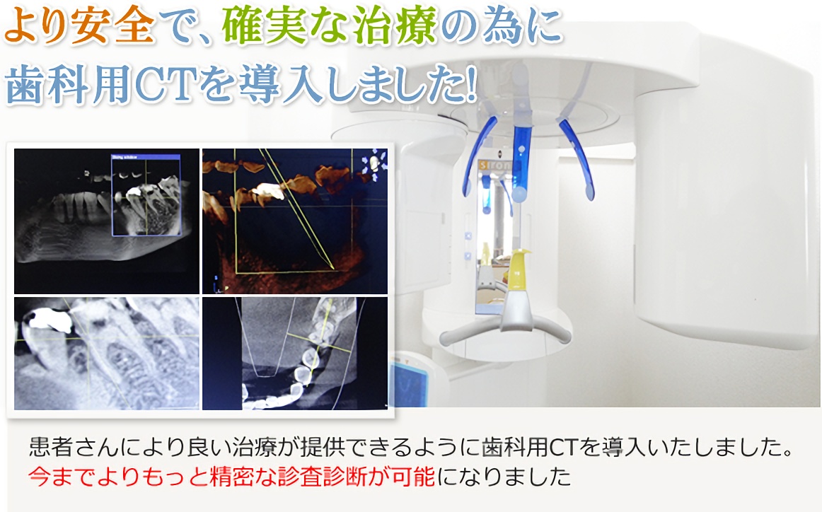 より安全で、確実な治療の為に歯科用CTを導入しました