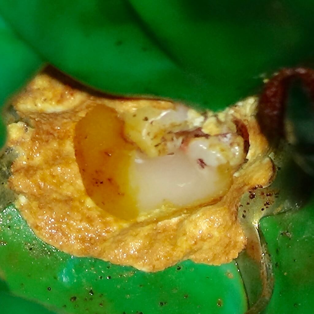 根管治療 再度消毒